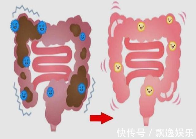 魔芋|减肥第一关，首先得清宿便！这些食物吃一吃，早上准时上厕所！