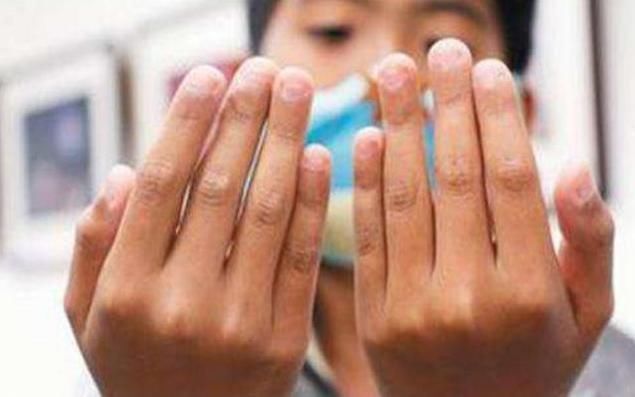 医生|小时候爱啃指甲的娃,长大会怎么样医生直言大概是这两种结局