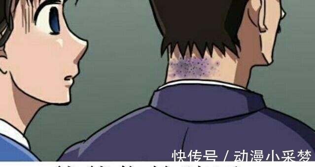 名侦探柯南|柯南:毛利小五郎究竟挨过多少针?看完后颈的CT照,网友:真坚强!