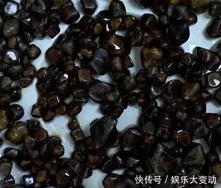 肥肉|一餐一斤肥肉吃不够,男子胆囊竟养出上千颗“巧克力豆”