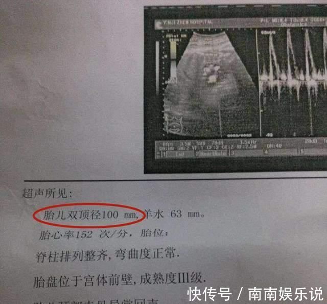 孕妈们|想顺产胎儿的双顶径有何要求?最好别超出此范围,否则分娩风险大