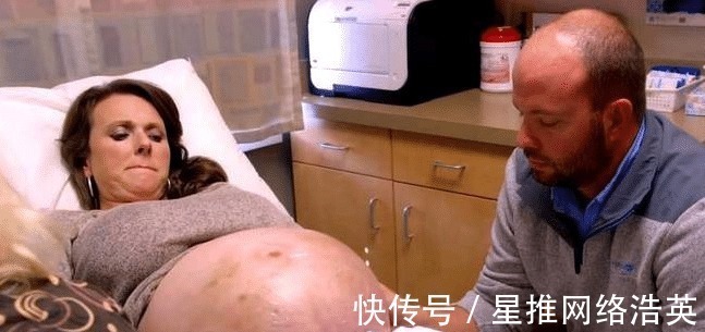 共和国|女子误以为怀双胞胎,医院产检才知,肚子里宝宝的数量打破了纪录