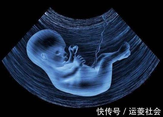 椰子|孕期严守八杯水还是发现羊水偏少,得知原因后,孕妈感到惭愧