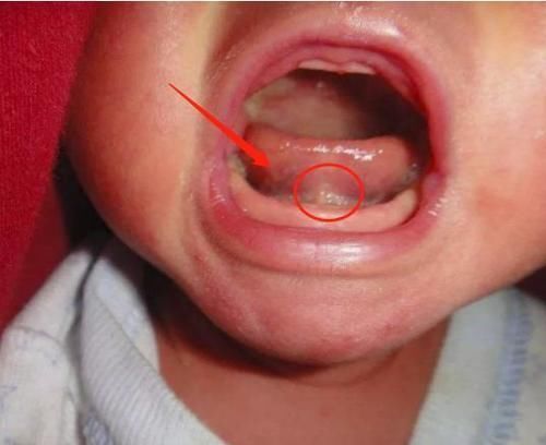 一个月|奶奶给满月孙子剃光眉毛,一个月后悔不当初,宝妈:您回老家吧