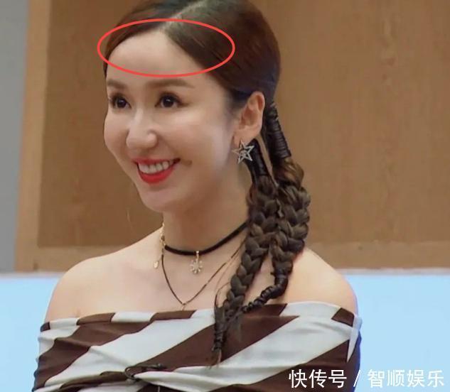 换掉“不合适”的发际线，普通女生也能轻松变美，显年轻也更耐看