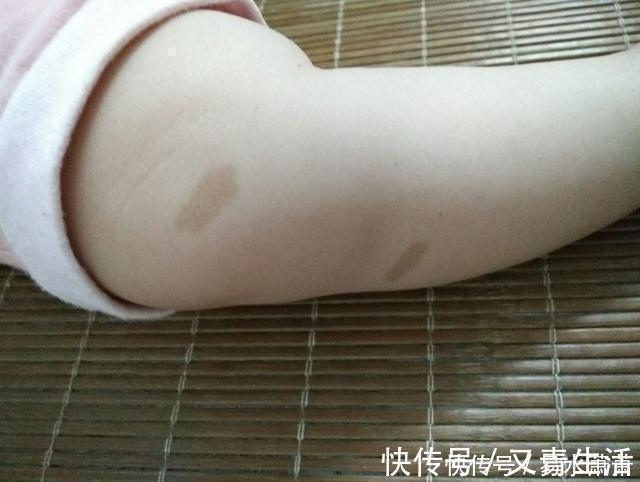 孕期|为什么有的宝宝会有“胎记”产科医生孕期要避免这3种行为