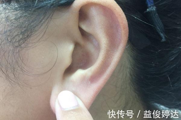 耳朵|耳朵大,耳垂大的人容易长寿或许真正容易长寿的是这三类人