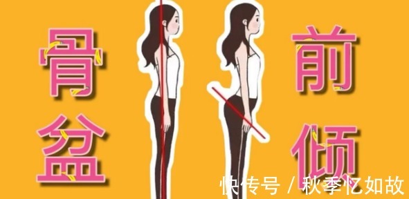 现实生活中|二次元内八字和罗圈腿成“审美”主流病态审美,不建议模仿!