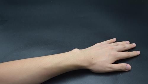 皮肤晒黑了怎么办?试试这个小妙招,皮肤更白更嫩滑,都看看吧