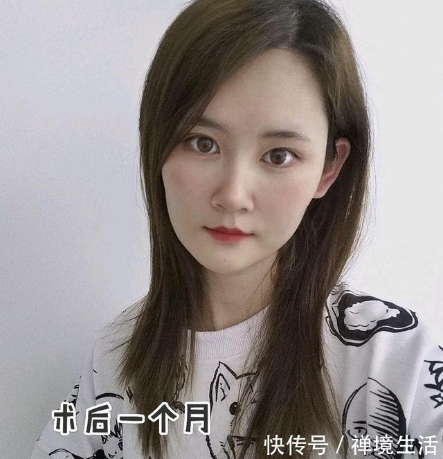 调皮 又去做光子嫩肤啦!真的是会上瘾!又去做光子嫩肤啦!真的是会上瘾!