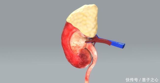 患上肾衰竭,3个注意事项,请牢记