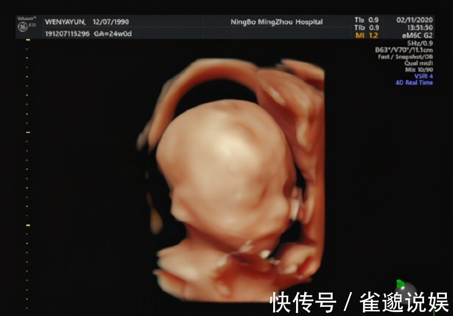 胎儿|有种产检叫“准爸爸不能缺席”,这5项产检,准爸爸再忙也要来