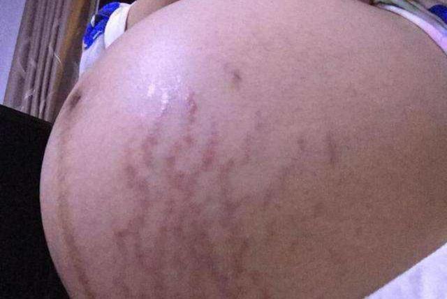 怀孕期间,肚子里是男孩还是女孩4种症状帮你判断,建议收藏