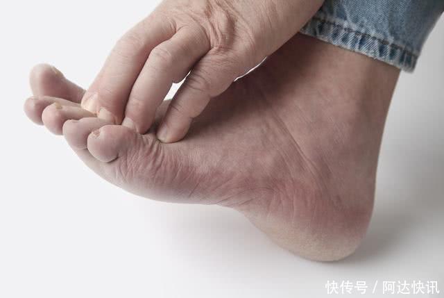 排便时，大便经常“前头干硬，后边软粘”，可能是3种病找上门了