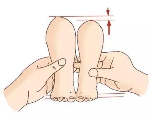 b超|宝宝腿纹不对称跟髋关节发育不良有什么关系，3种情况要注意
