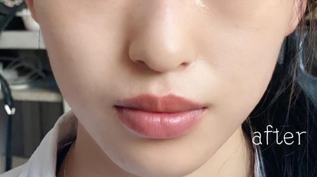 防晒 坚持用了“4年”防晒霜,皮肤发生了“大改变”,不止变白了!