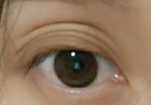 你的眼皮都有几层了?