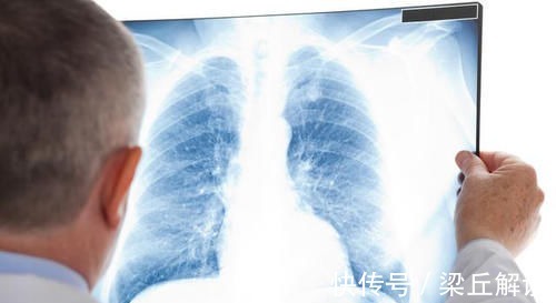 症状|有些症状不可忽视,可能是肺癌的肺外表现,早诊断早治疗痛苦小