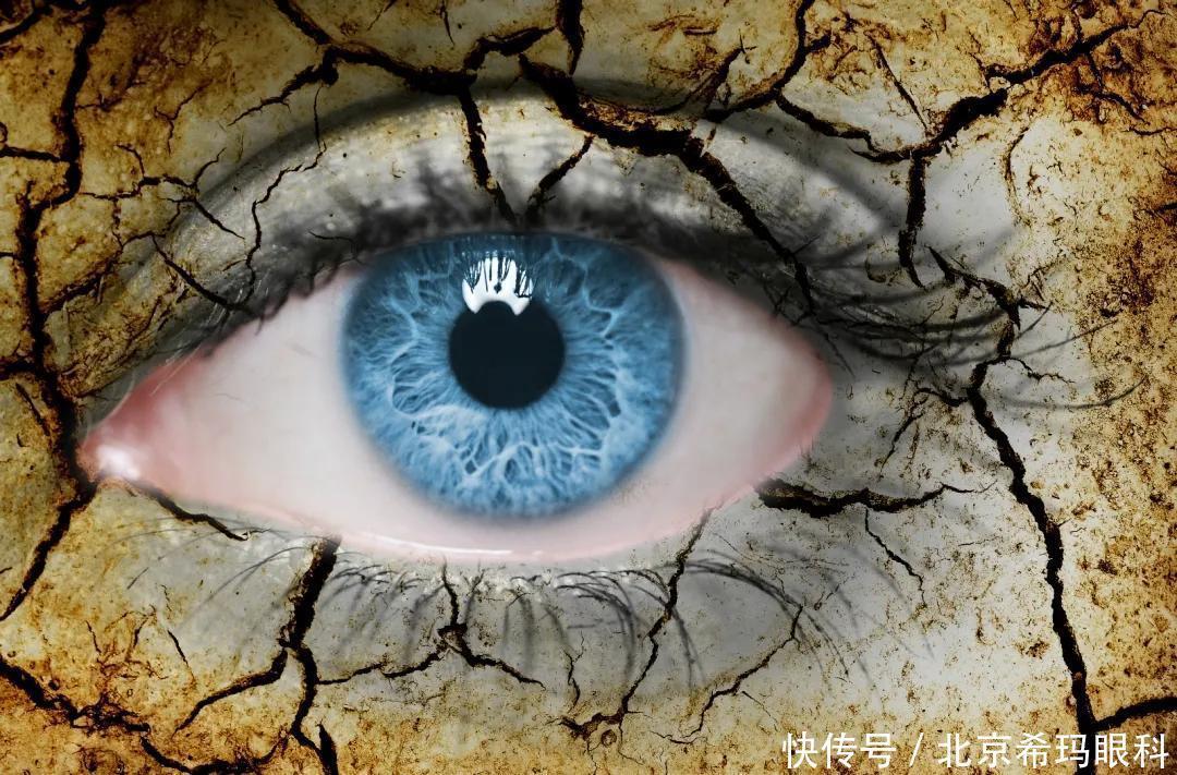 这个慢性眼病,也许此刻就发生在你身上