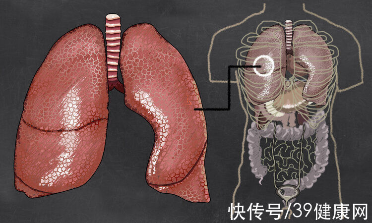 间皮瘤|一级致癌物石棉已被66国禁用，潜伏期达数十年，或正潜伏在你身边