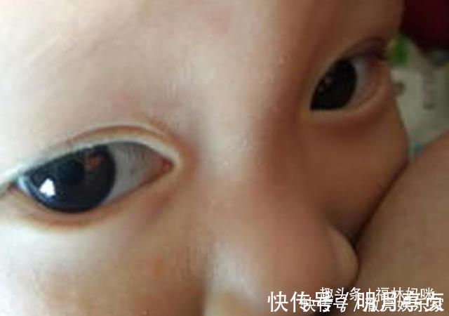 宝妈|孩子眼白上的黑斑是什么爸妈别慌,可能是这两种情况