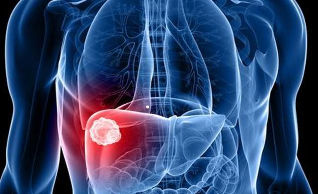 优质蛋白|经常喝酸奶,是养肝还是伤肝?医生道出实情,最好了解下