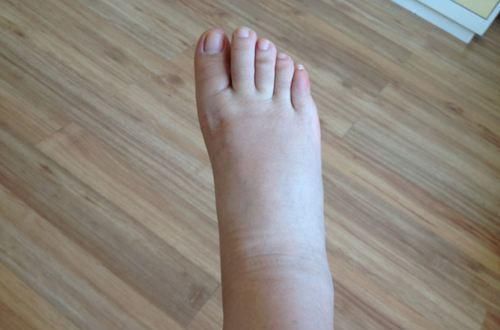 动作|睡前坚持这个动作10分钟,一段时间后,或能尝到这三个“甜头”