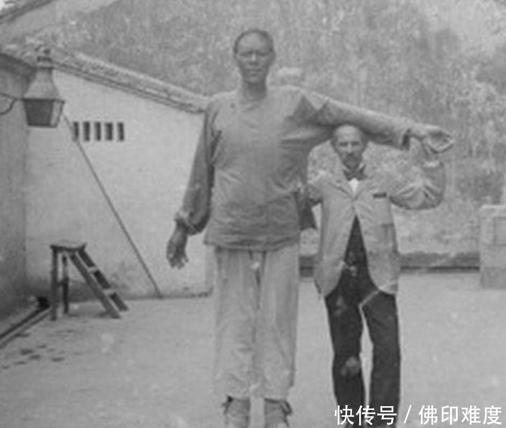 外国|晚清巨人老照片:身高超过3米,入英国籍贯,娶英国美女为妻!