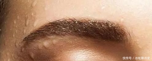 肾阴虚体质|医生坦白说:容易出汗的人,一般都是什么体质?打开天窗说亮话