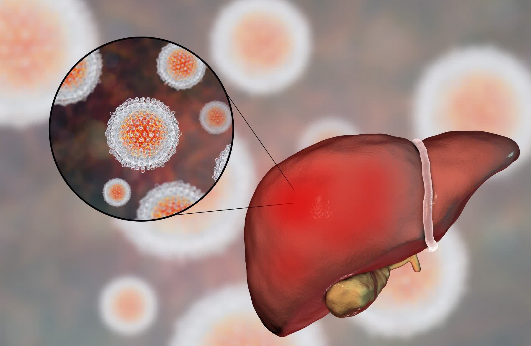 患癌|肝癌晚期,却奇迹般痊愈!38岁刘先生做对了3事,战胜了肝癌