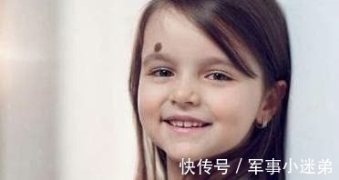 宝宝|若不想让宝宝留下胎记,孕期就别太任性,尽量不要有这4种行为