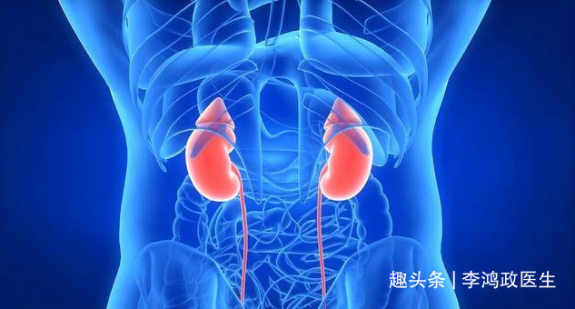 蛋白质|女子双脚水肿,诊断肾病综合征,直到出现咳嗽医生才发现是肺癌