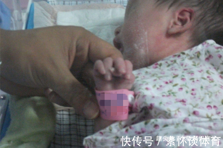 晓玲|宝宝出生长了“凤爪”，宝妈谎称孕期吃了鸡爪，却被医生当场揭穿
