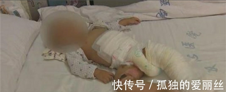 妈妈|三岁小女孩碰中开水壶,重度烫伤,妈妈喊到:没别忙活了,让她走