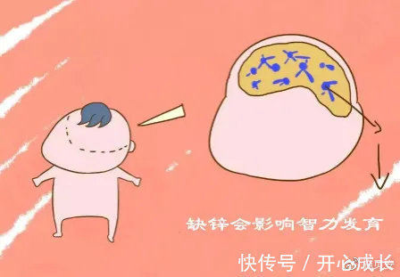 孩子们|孩子缺锌影响智力发育,当他有这些表现时,宝妈该给他补锌了