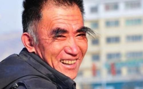 医生|不论男女，眉毛变长，意味着什么呢？听听医生怎么说