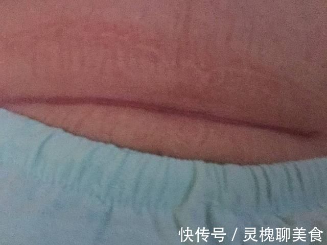 大宝|第一次剖腹和第二次有什么不同医生说出实话,孕妈要心里有数