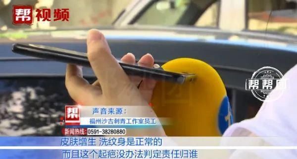 皮肤起泡化脓留疤,医生提醒,做这事得谨慎!