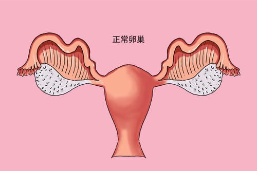 女性注意：黄体破裂危险不小，经期前后务必小心