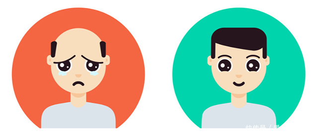 植发,不想被“套路”,这样做!