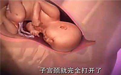 胎头那么大，到底是怎样从那么小的口出来顺产分娩全过程-附图