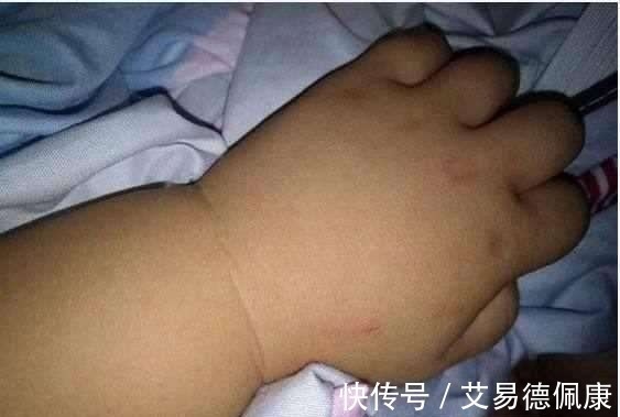 爷爷奶奶|3岁宝宝神志不清, 流口水离世, 医生的话爷爷奶奶不接受