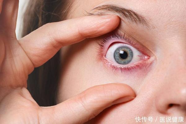 身体出现4个变化，或是肝病来报到了，需留心观察