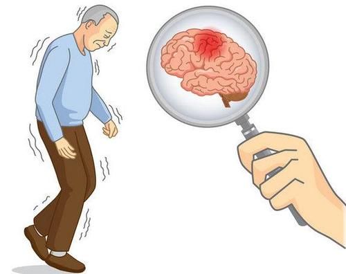 人过五十，不想中风，有哪些习惯最好改掉？
