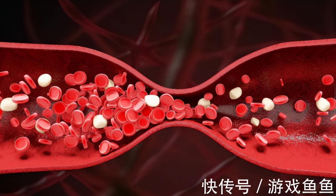 眼部|面部出现3种异常,说明血脂偏高,养成3个好习惯,或利于血脂稳定