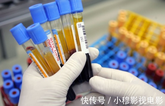 3物|大叔1年3次脑梗,最终离世,医生:吃3物等于喝一桶油,血管不堵才怪