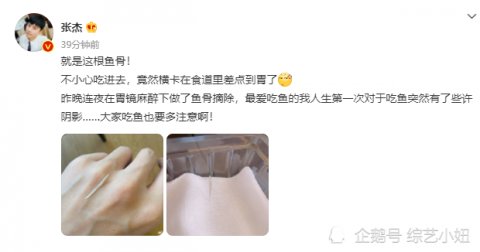 人生第一次|张杰被鱼骨卡食道,连夜胃镜麻醉摘除,自称吃鱼留下阴影