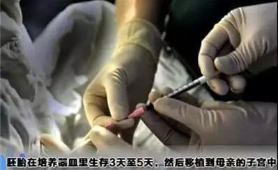 做试管婴儿的全部过程(附图解),看着都疼,可怜天下父母心
