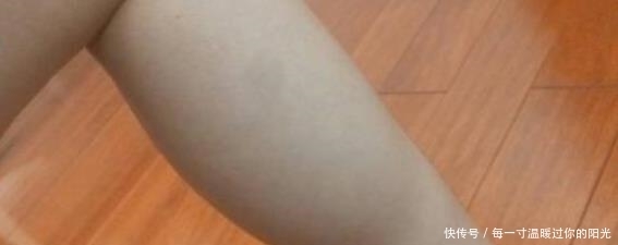 补救|“骨骺线”闭合前3大信号，父母及时补救，孩子还能长到180cm