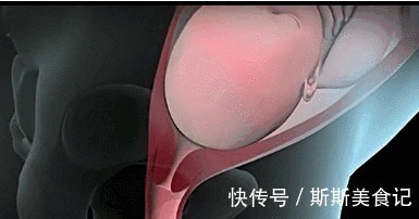 宫缩|胎儿入盆后多久会生?有这些症状的,悄悄告诉你,Ta准备出来啦